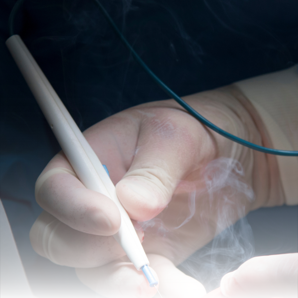 Hazards of Diathermy Surgical Smoke Blog